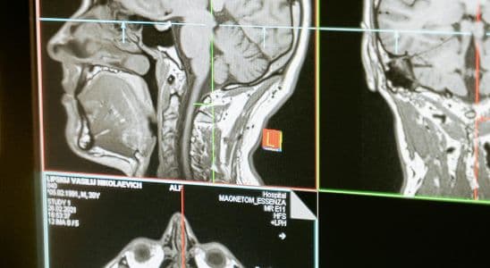 Tècnic Superior en Imatge per al Diagnòstic i Medicina Nuclear