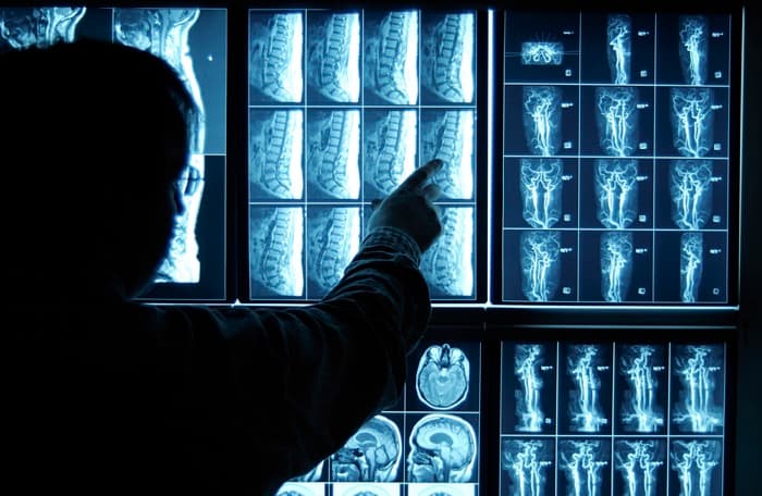 Imatge Per Al Diagnòstic I Medicina Nuclear a Universanidad Logroño (Universanidad Logroño): foto 2